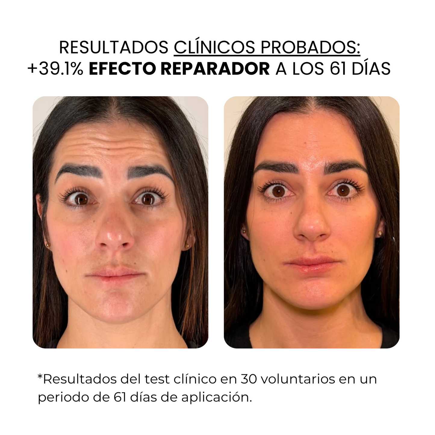 Derma Stamp Antiedad | Microneedling con Ácido Hialurónico