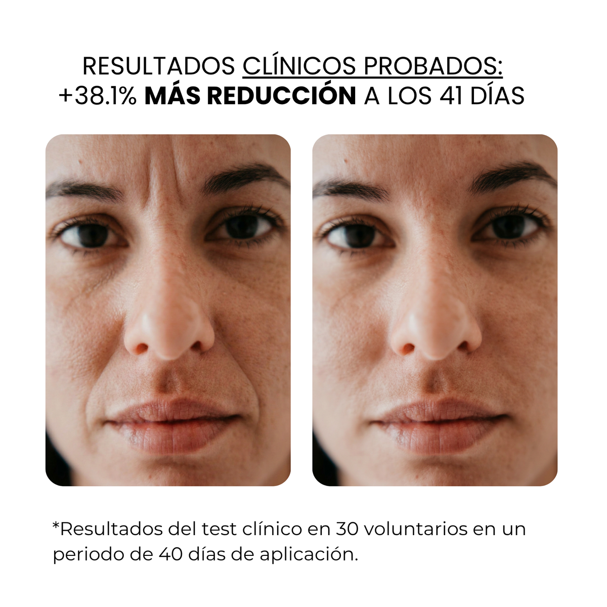 Tratamiento antiedad con aqua stamp