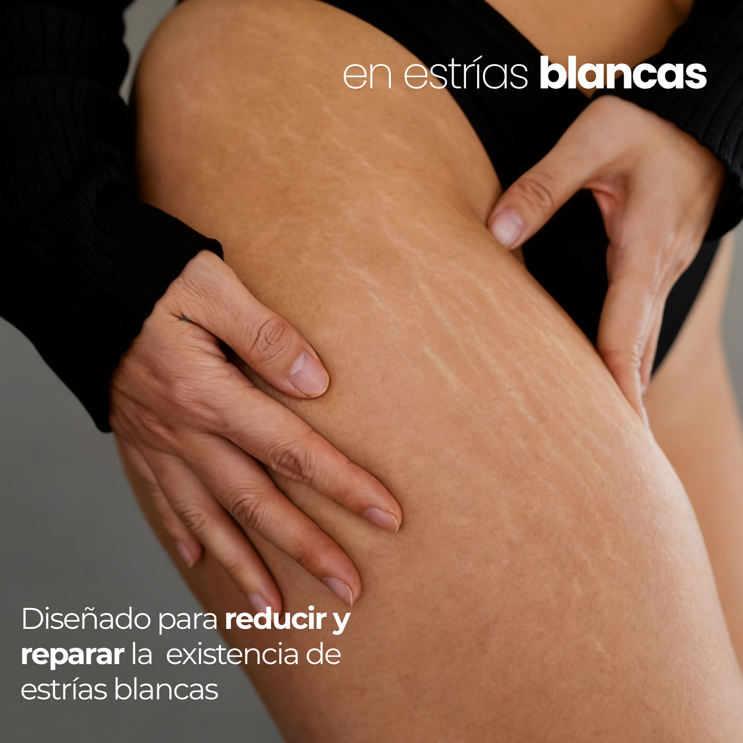 Derma Stamp Antiestrías | Microneedling con Ácido Hialurónico