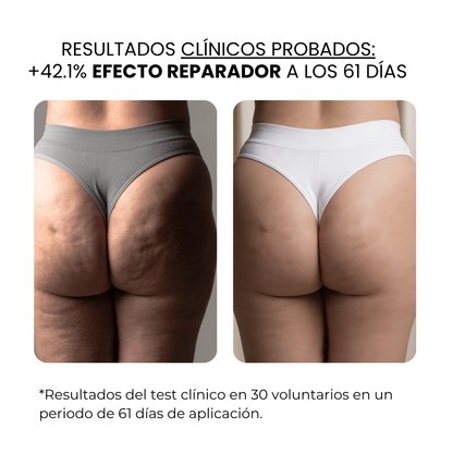 Derma Stamp Antiestrías | Microneedling con Ácido Hialurónico