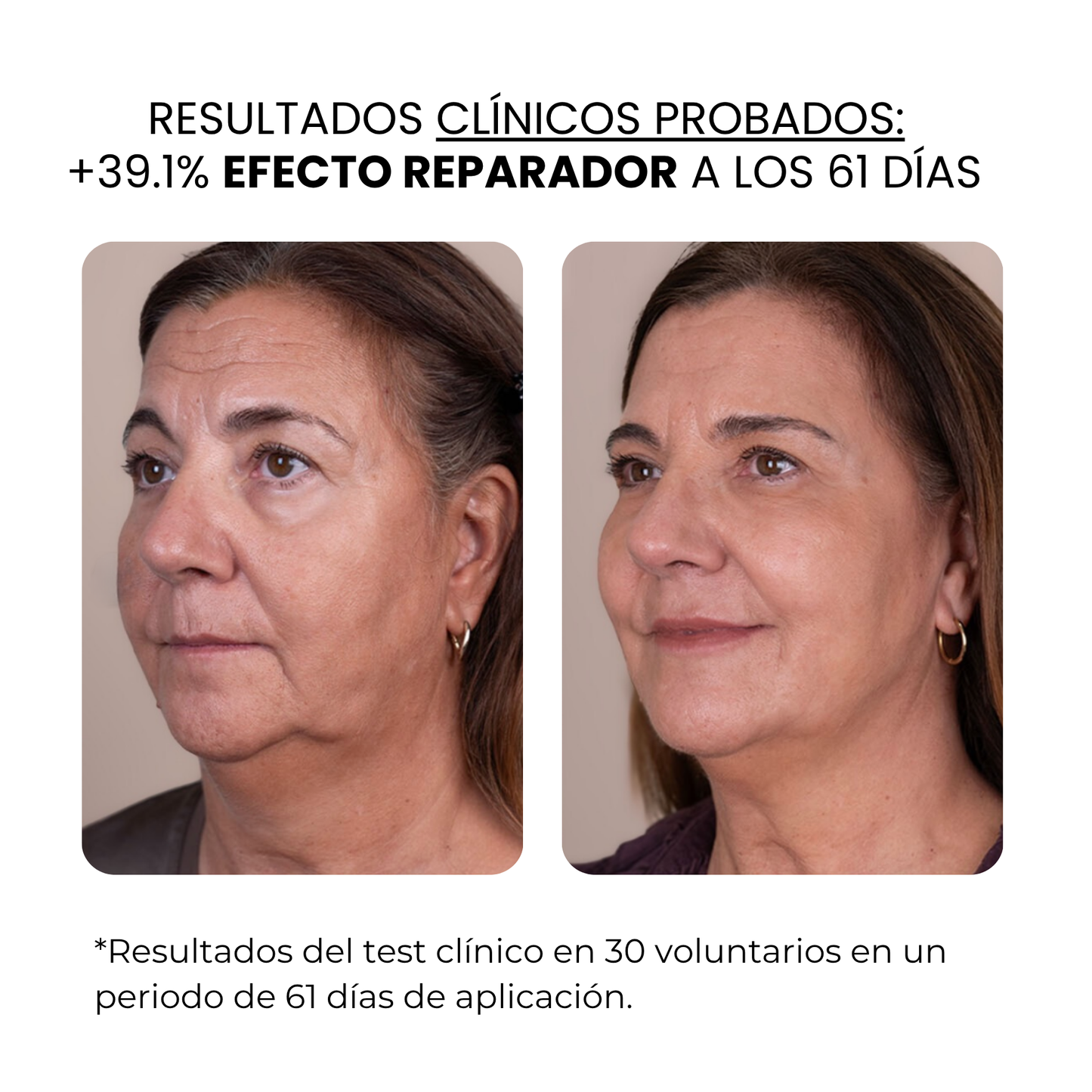 Derma Stamp Antiedad | Microneedling con Ácido Hialurónico