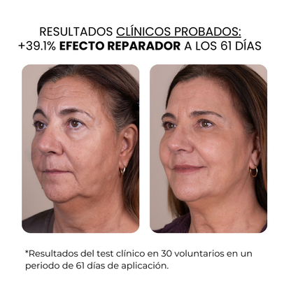 Derma Stamp Antiedad | Microneedling con Ácido Hialurónico