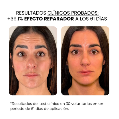 Derma Stamp Antiedad | Microneedling con Ácido Hialurónico