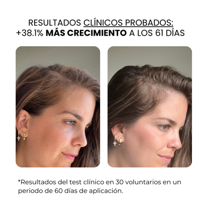 Derma Stamp Crecimiento Capilar Femenino | Microneedling con Sérum Hair Growth
