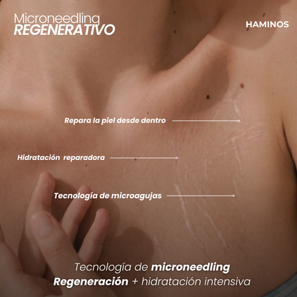Tratamiento Anti Estrías | HAMINOS®
