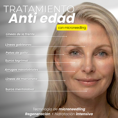 Tratamiento antiedad con aqua stamp