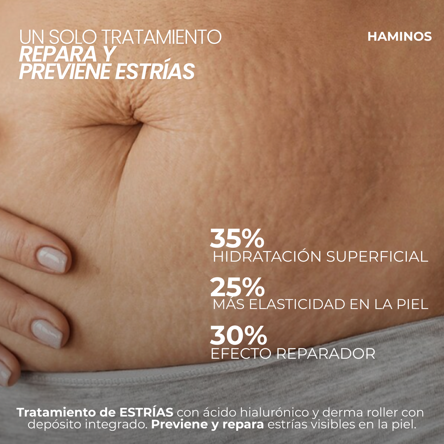 Tratamiento Anti Estrías | HAMINOS®