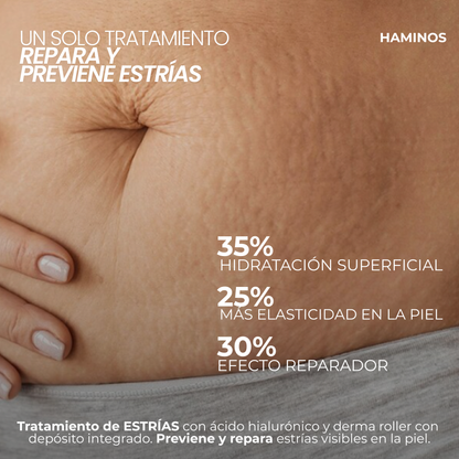 Tratamiento Anti Estrías | HAMINOS®