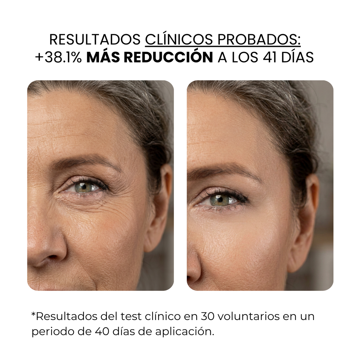 Tratamiento antiedad con aqua stamp