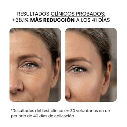 Tratamiento antiedad con aqua stamp