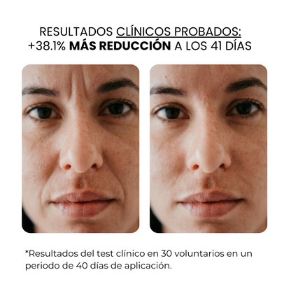 Tratamiento antiedad con aqua stamp
