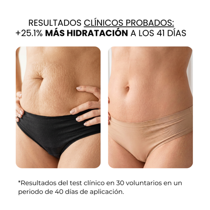 Tratamiento Anti Estrías | HAMINOS®