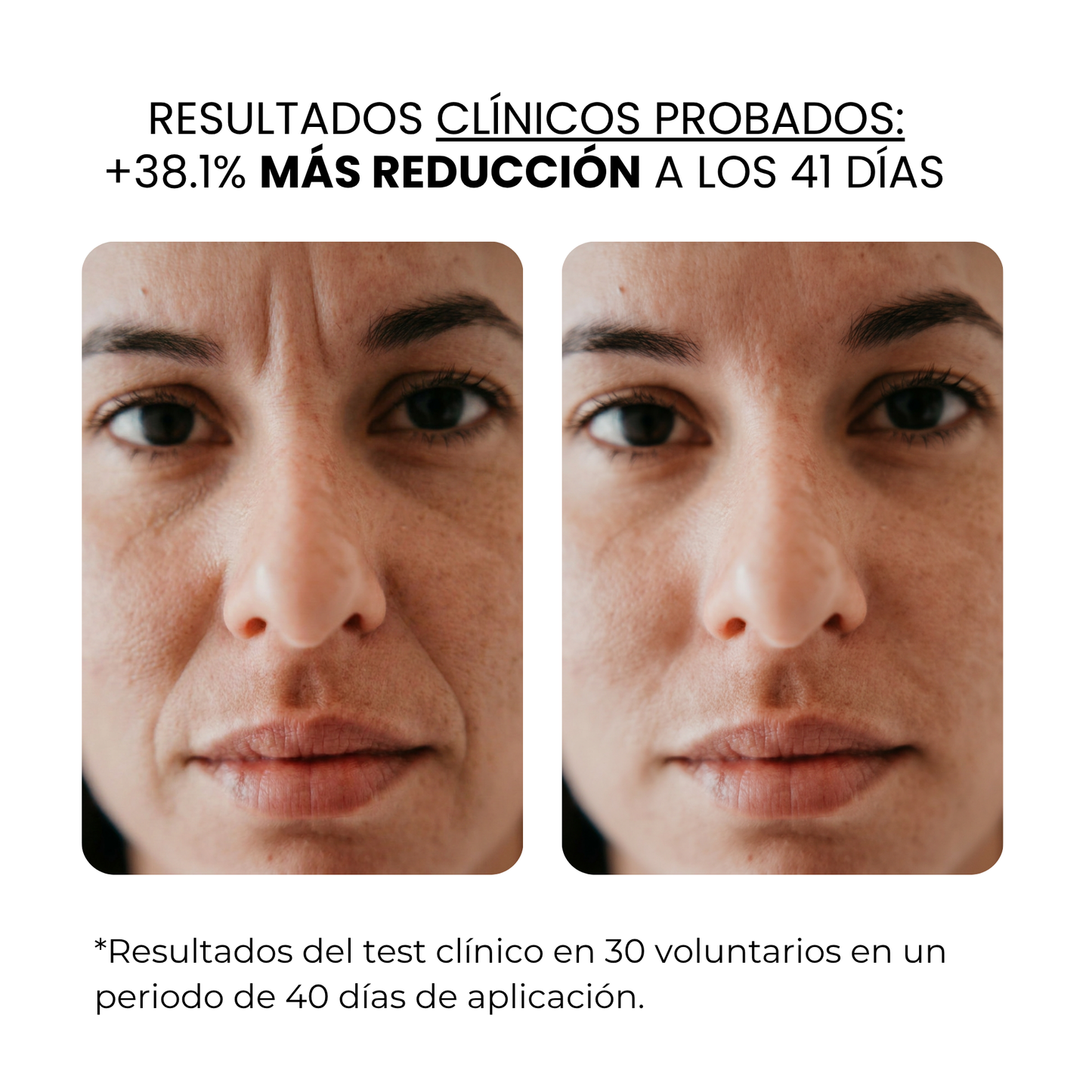 Tratamiento Antiedad y Nutritivo | HAMINOS®