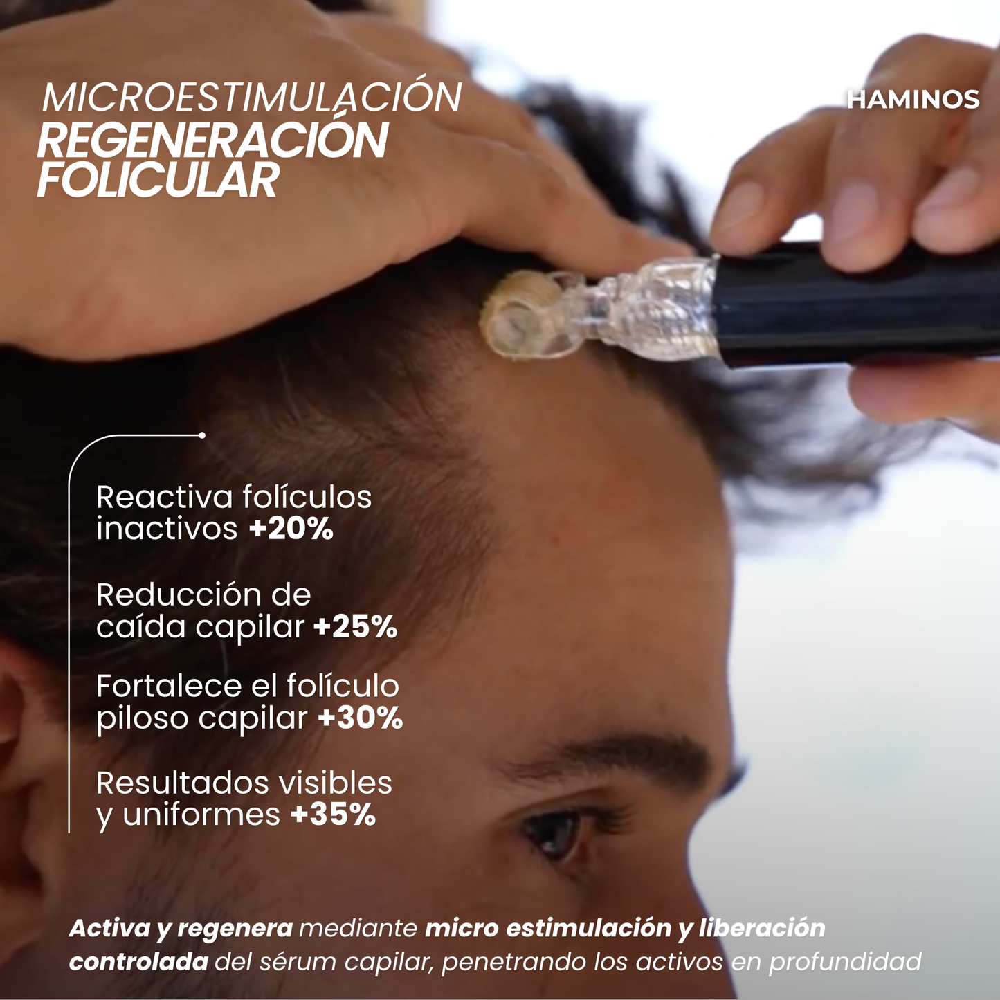Tratamiento de Crecimiento Capilar y Barba | HAMINOS®