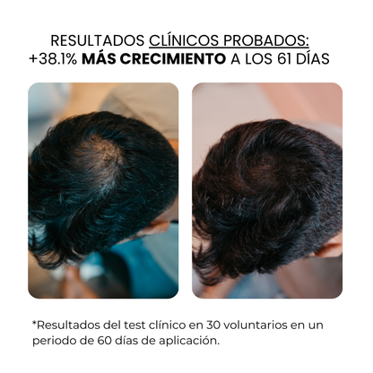 Tratamiento de Crecimiento Capilar y Barba | HAMINOS®