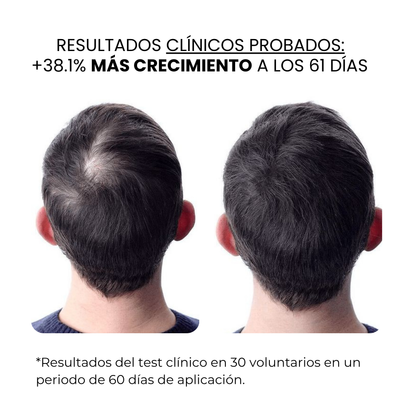 Tratamiento de Crecimiento Capilar y Barba | HAMINOS®