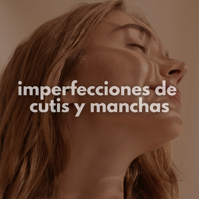 Manchas