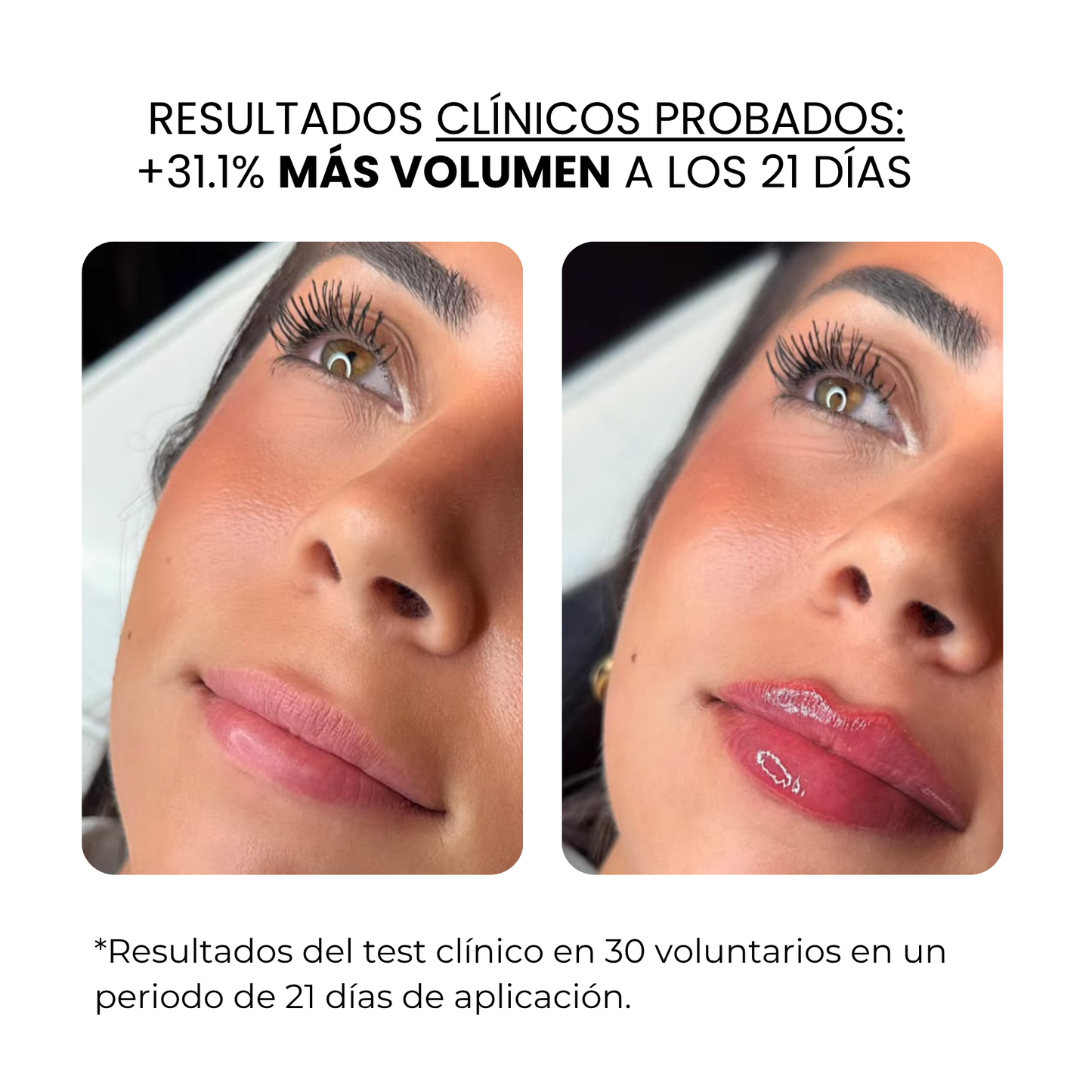 Tratamiento Labial | HAMINOS®