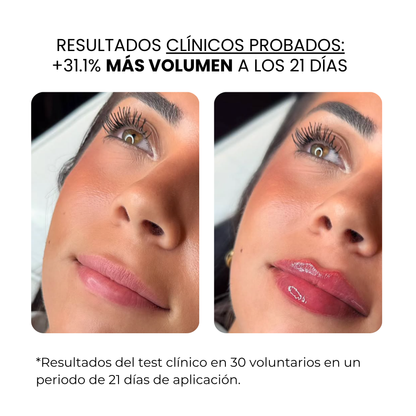 Tratamiento Labial | HAMINOS®