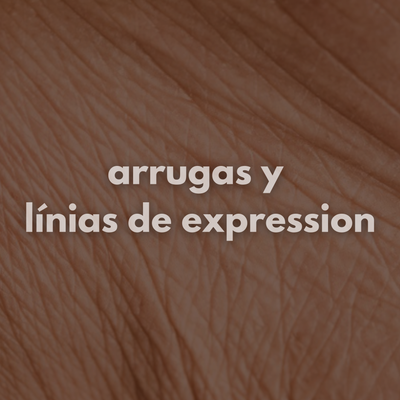 Arrugas