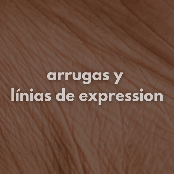 Arrugas