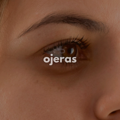 Ojeras
