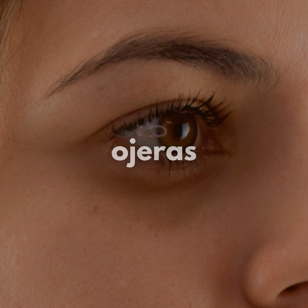 Ojeras
