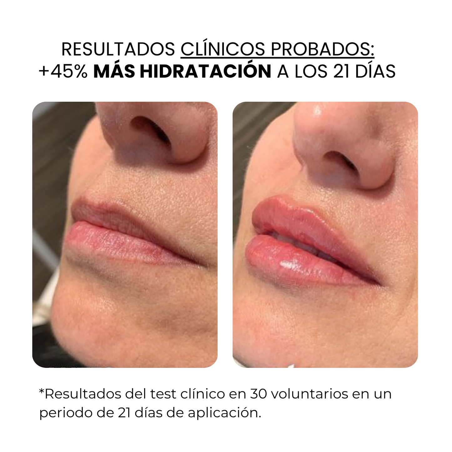 Tratamiento Labial | HAMINOS®