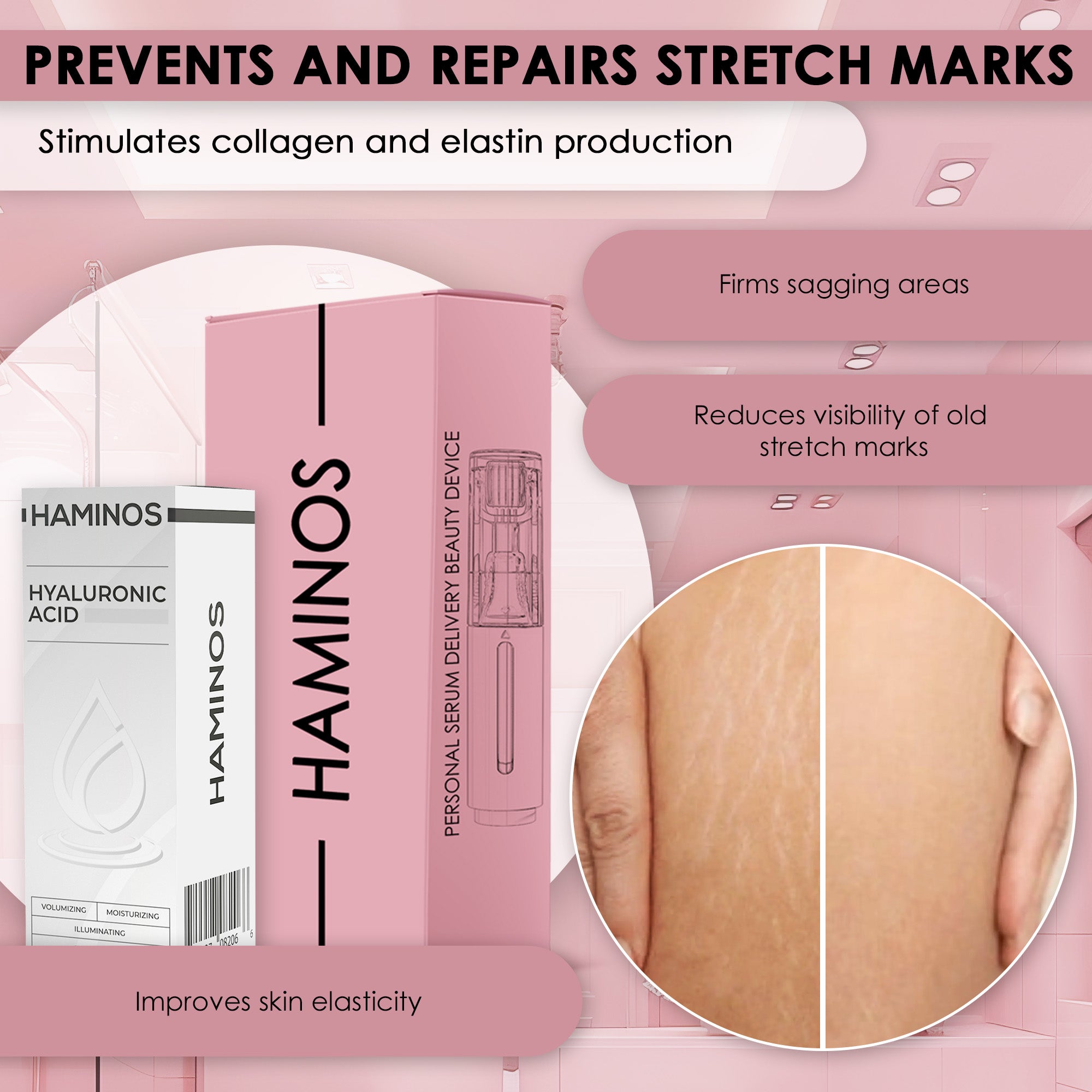 STRETCH MARKS PACK | HAMINOS®